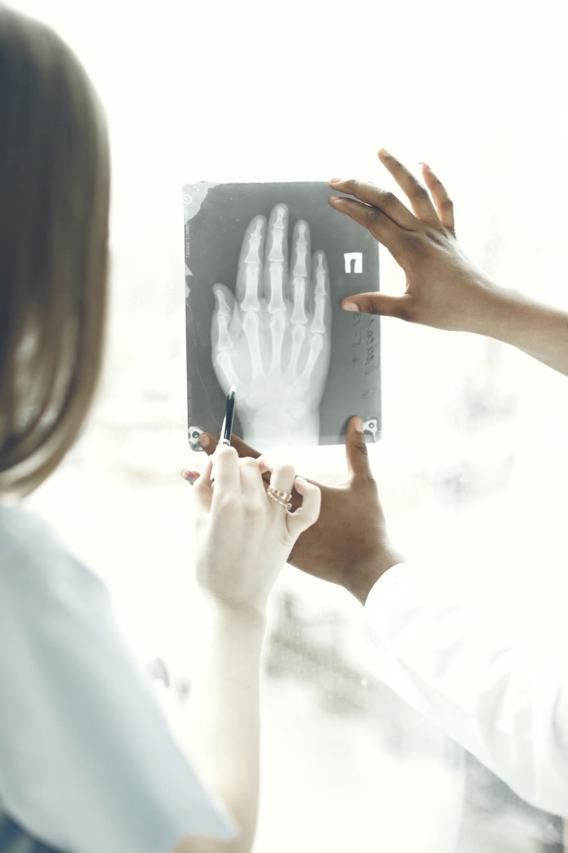 Radiografia di una mano esaminata da due operatori